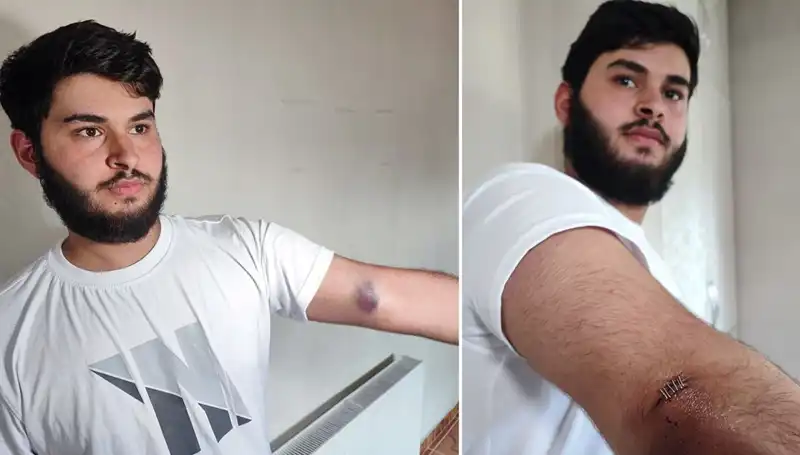 Bahçeye Kaçan Top, Mahallede Kamyonet Krizine Neden Oldu