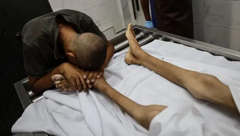 Gazze'de Açlık Savaşları: Küçük Bir Can Daha Hayatını Kaybetti